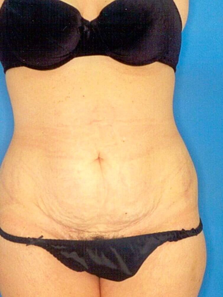 Before Image