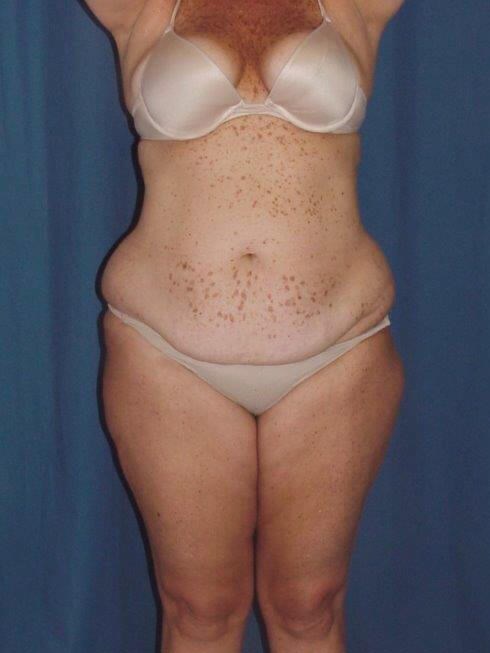 Before Image