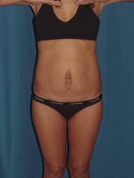 Before Image