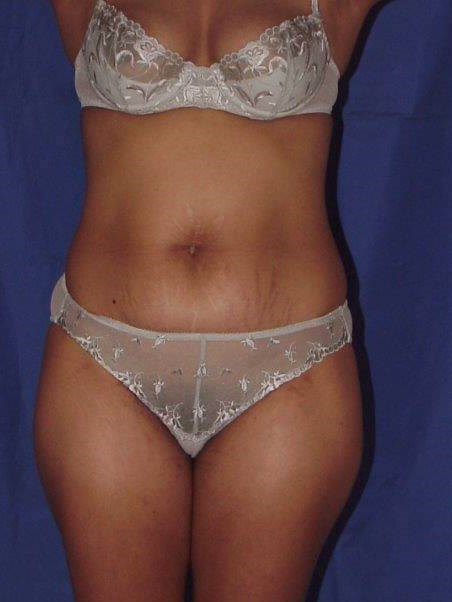 Before Image
