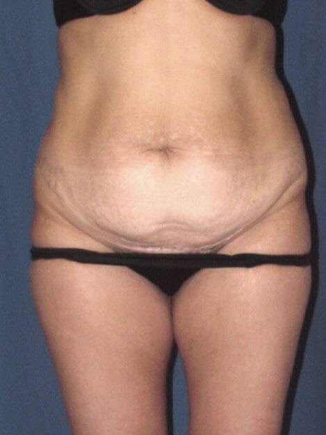 Before Image