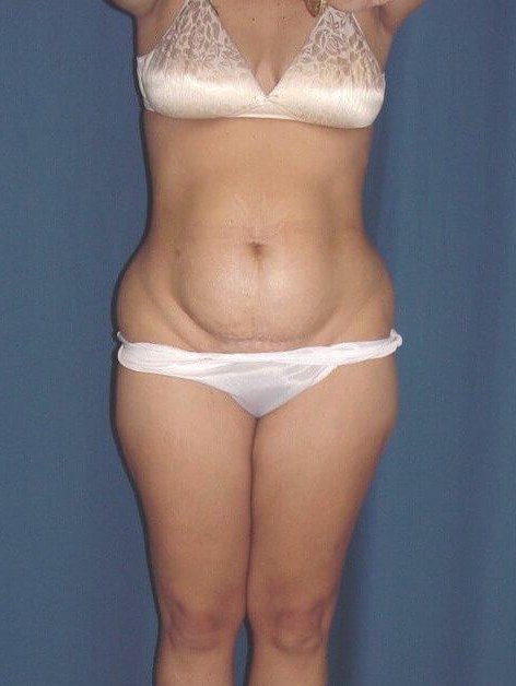 Before Image