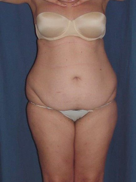 Before Image