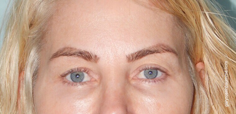 Before Image