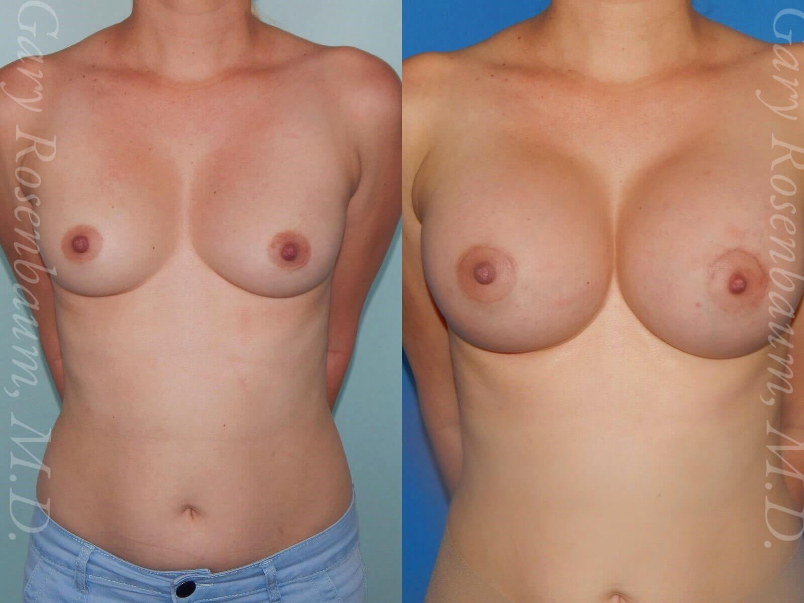 Before Image