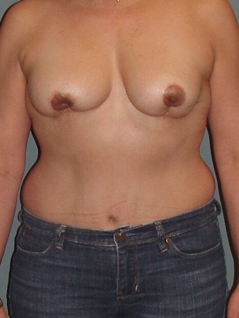 Before Image