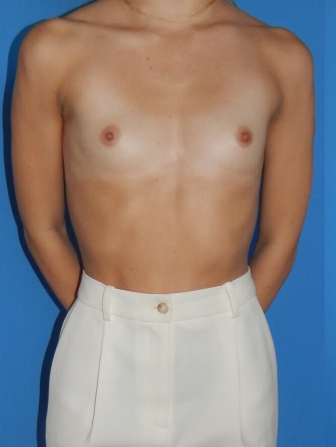 Before Image