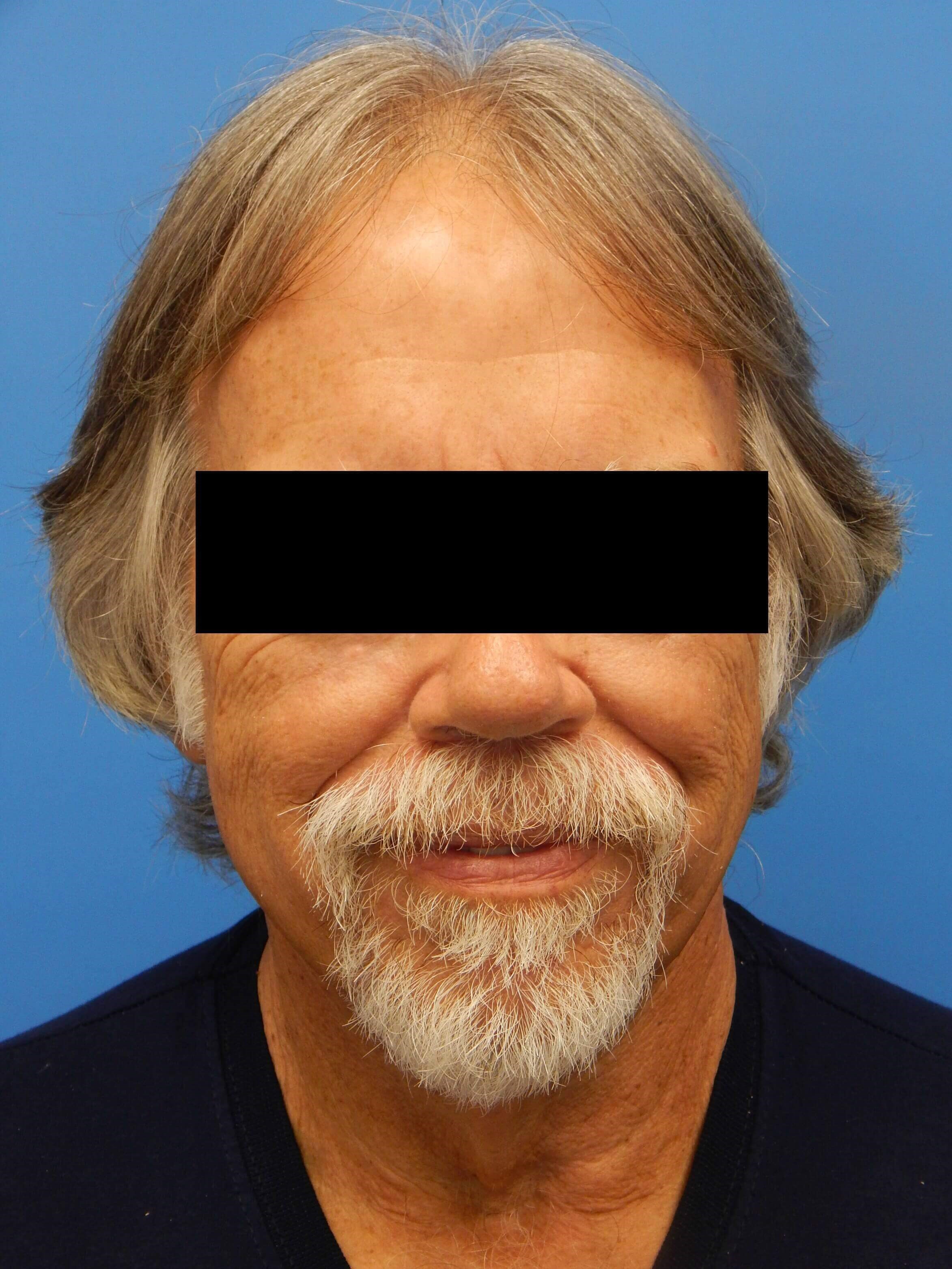 Before Image