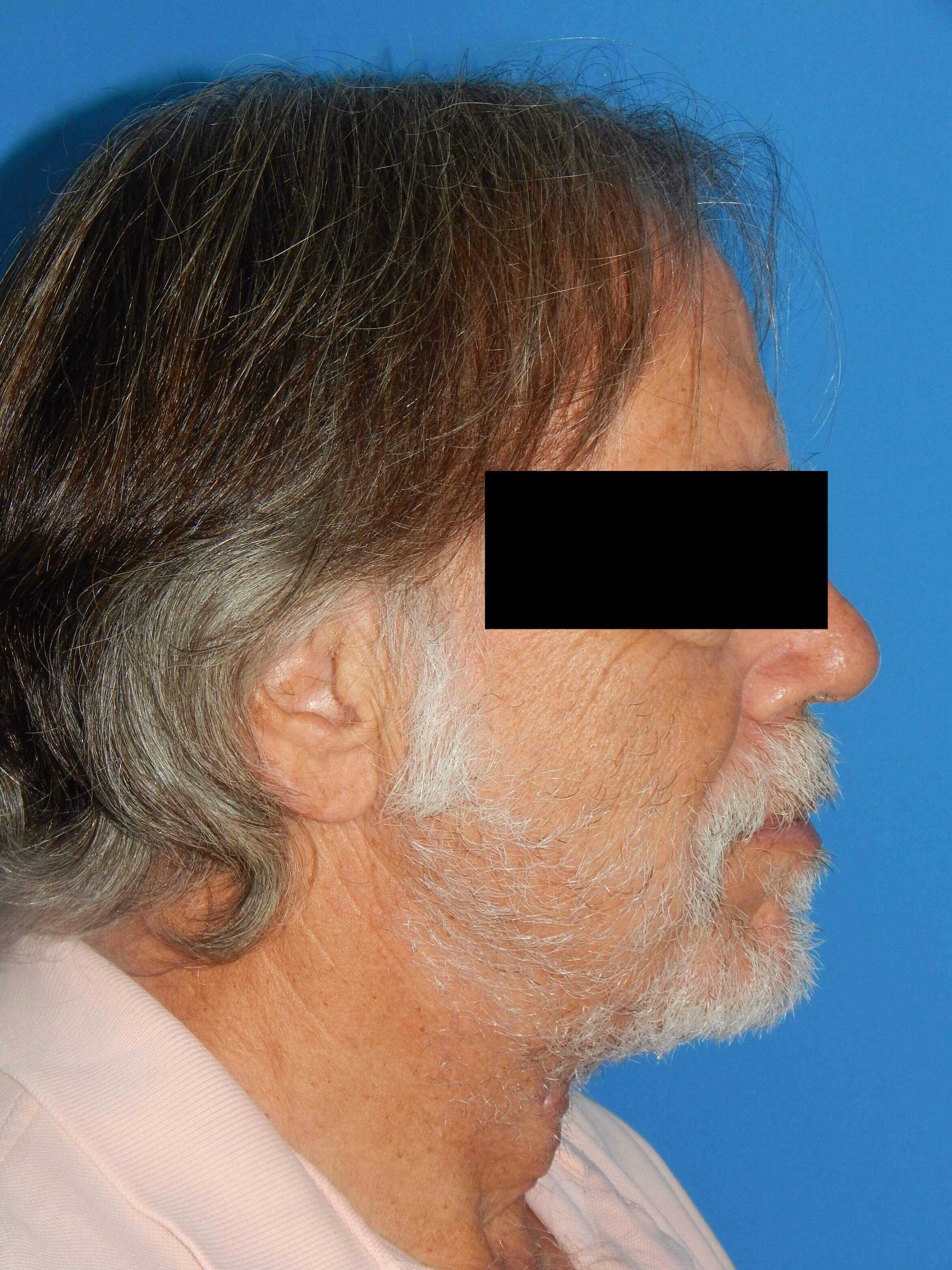 Side View-loose hanging neck s After