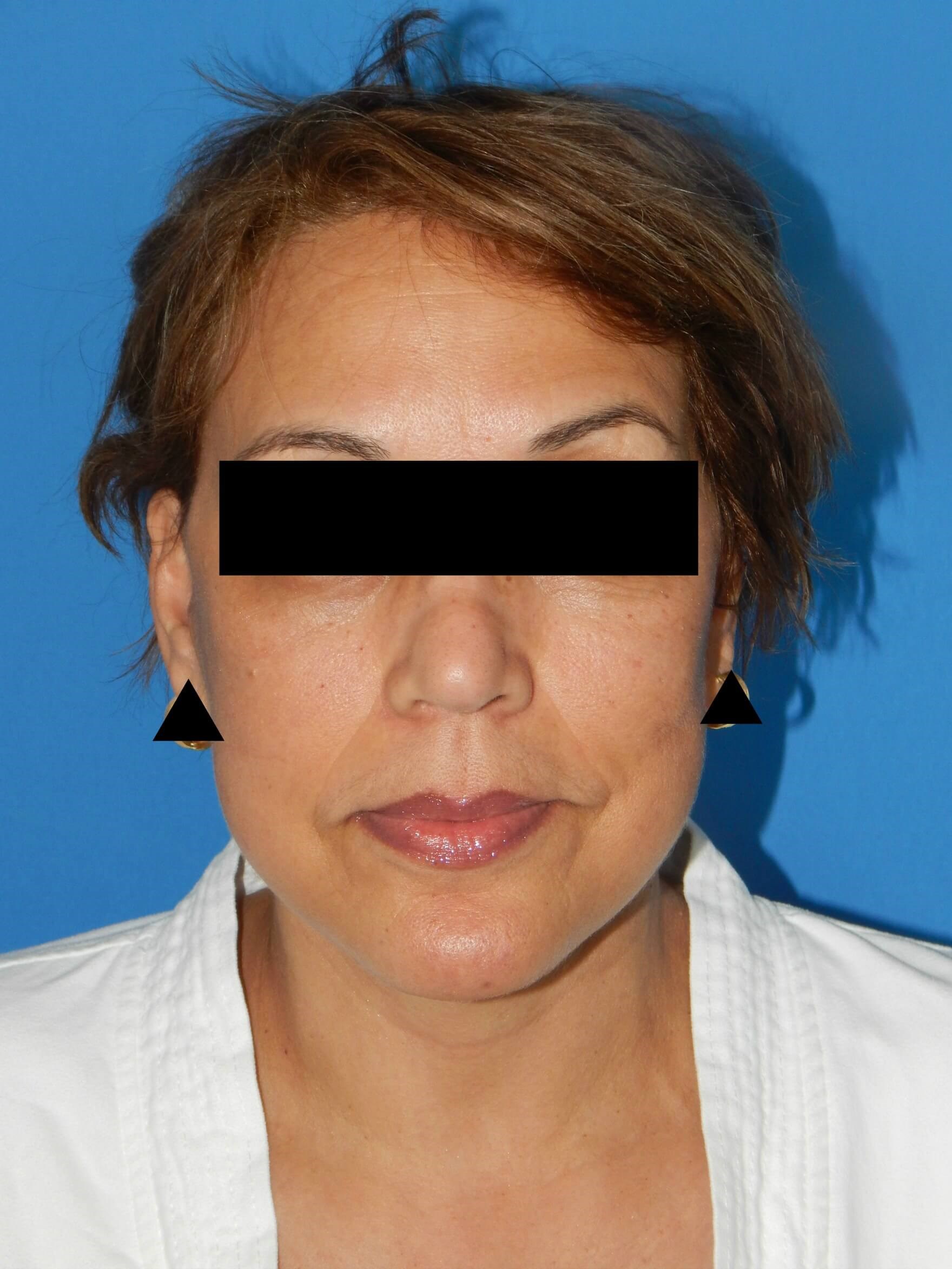 After Image
