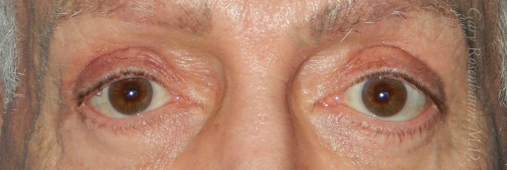After Image
