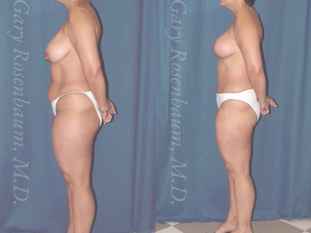 After Image