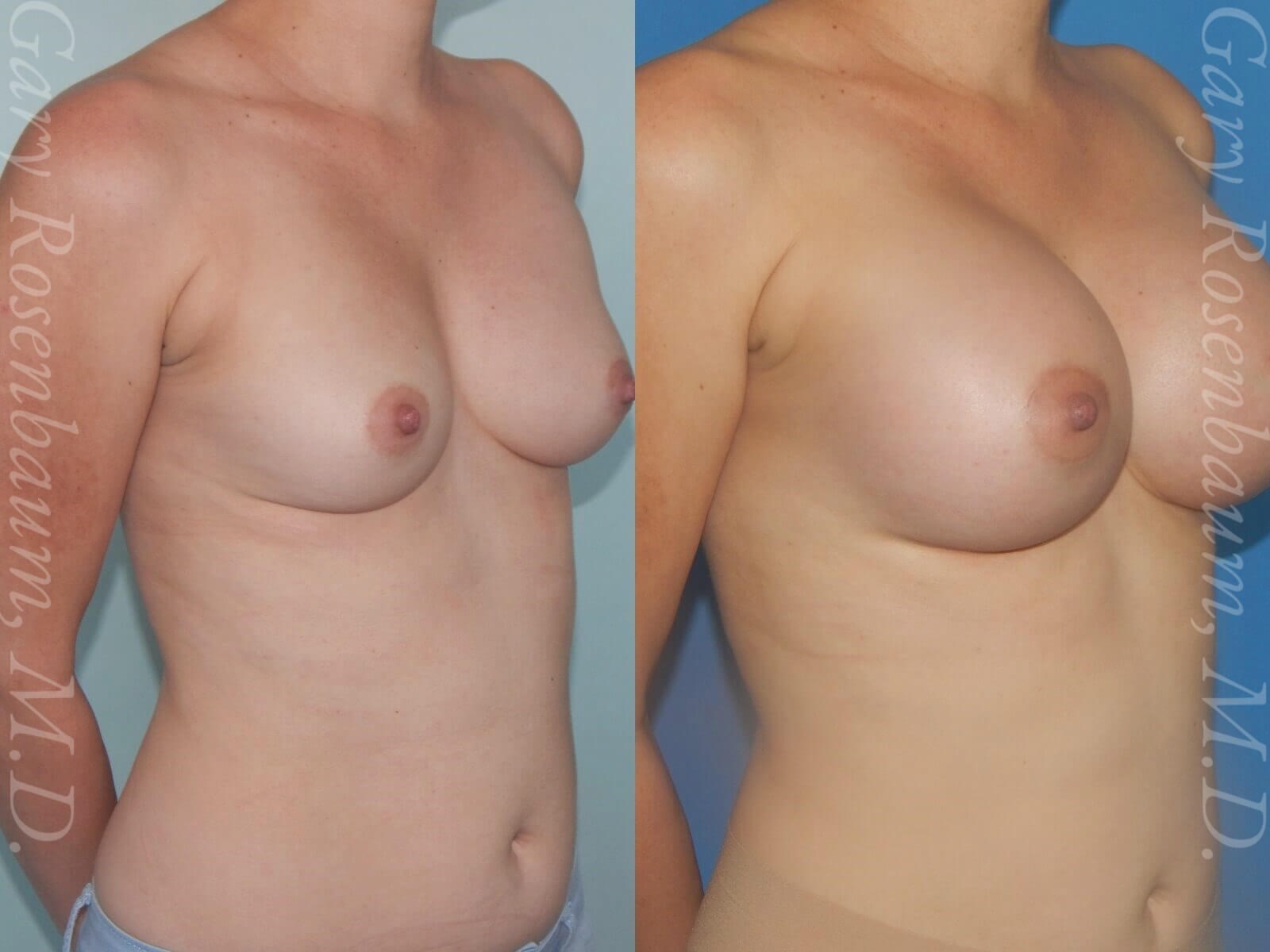 After Image