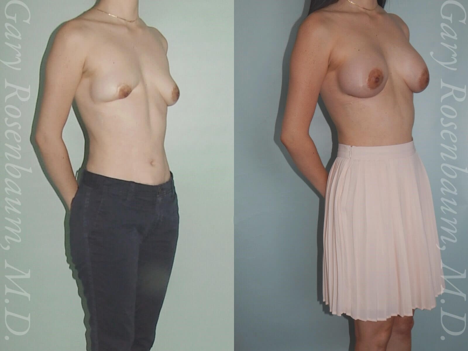 After Image