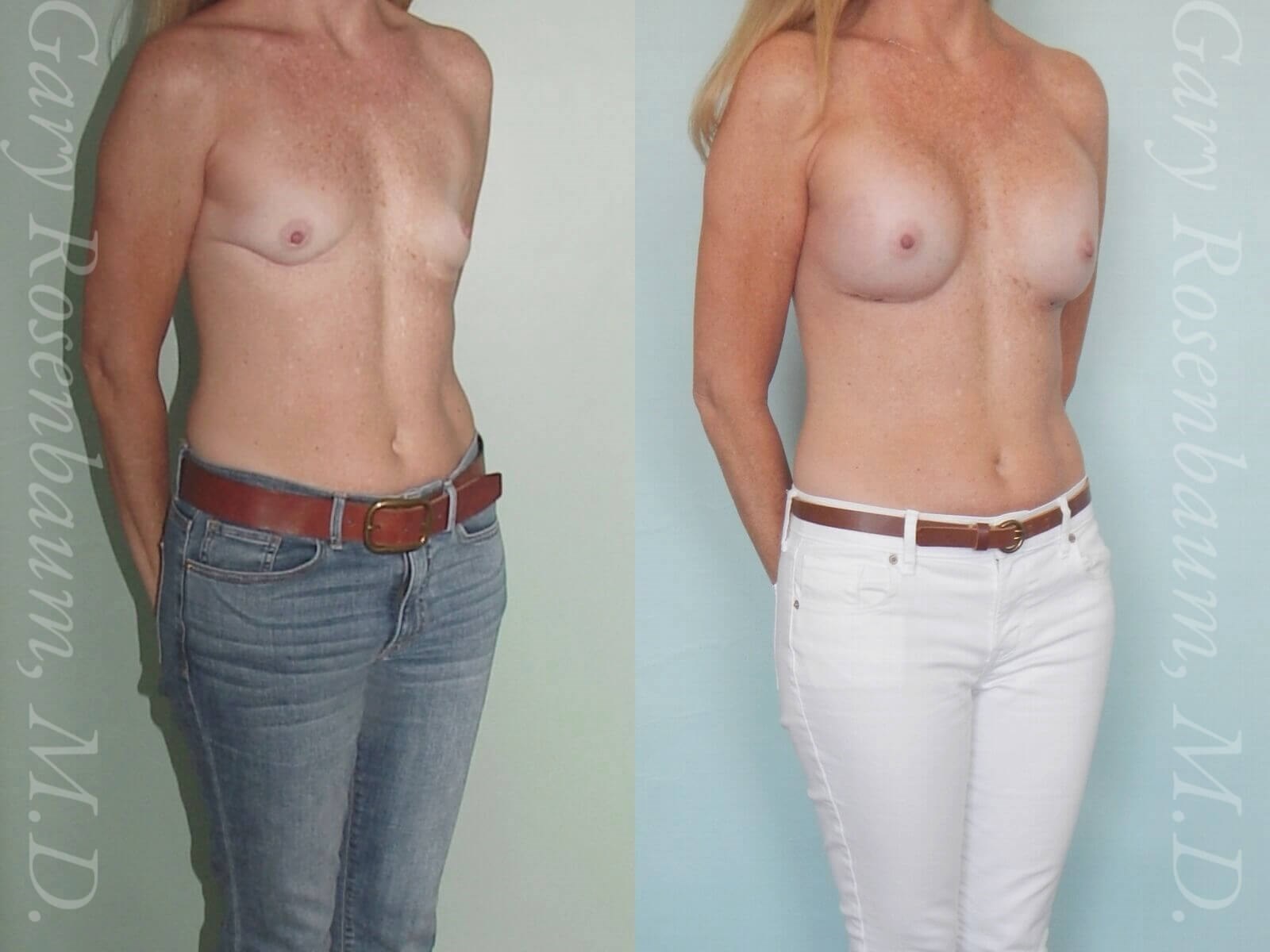 After Image