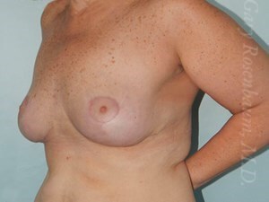 After Image