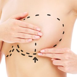 Breast Revision Surgery