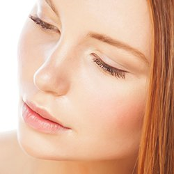 Brow Lift